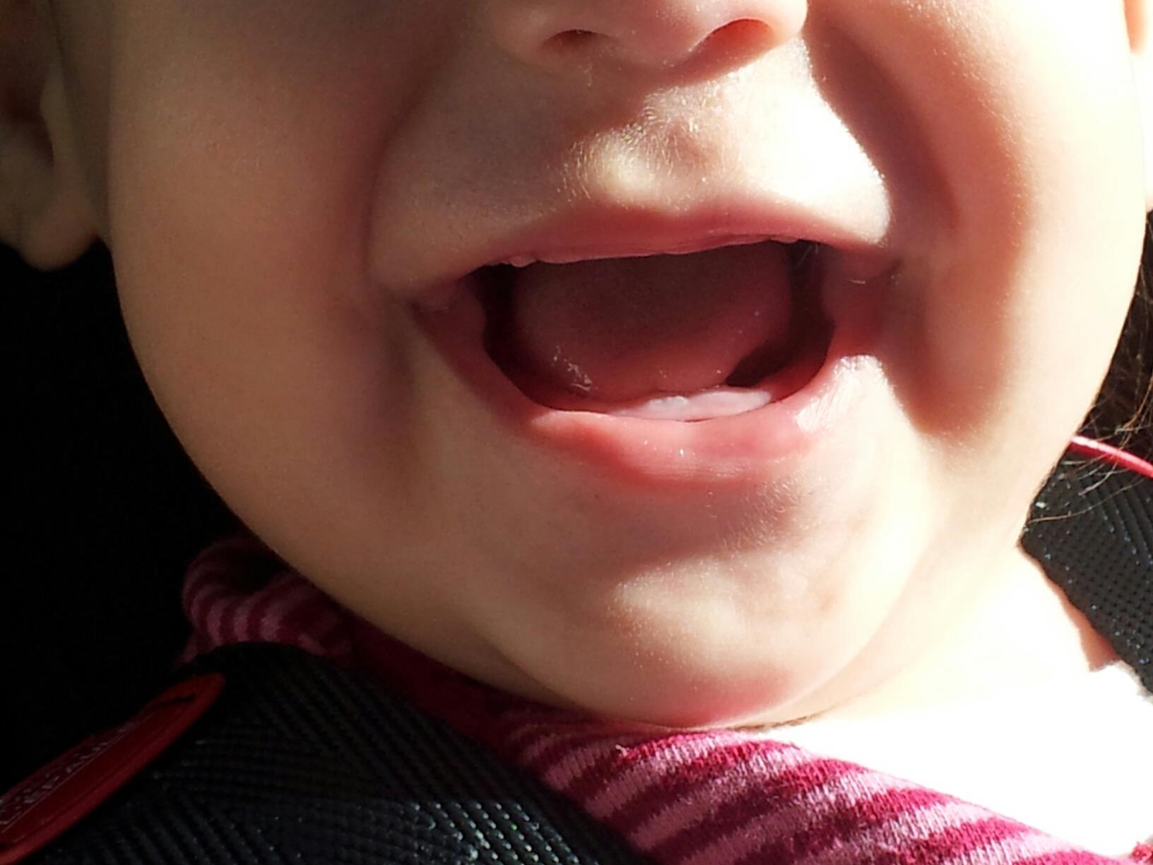 toothy delight SmadarHalperinEpshtein